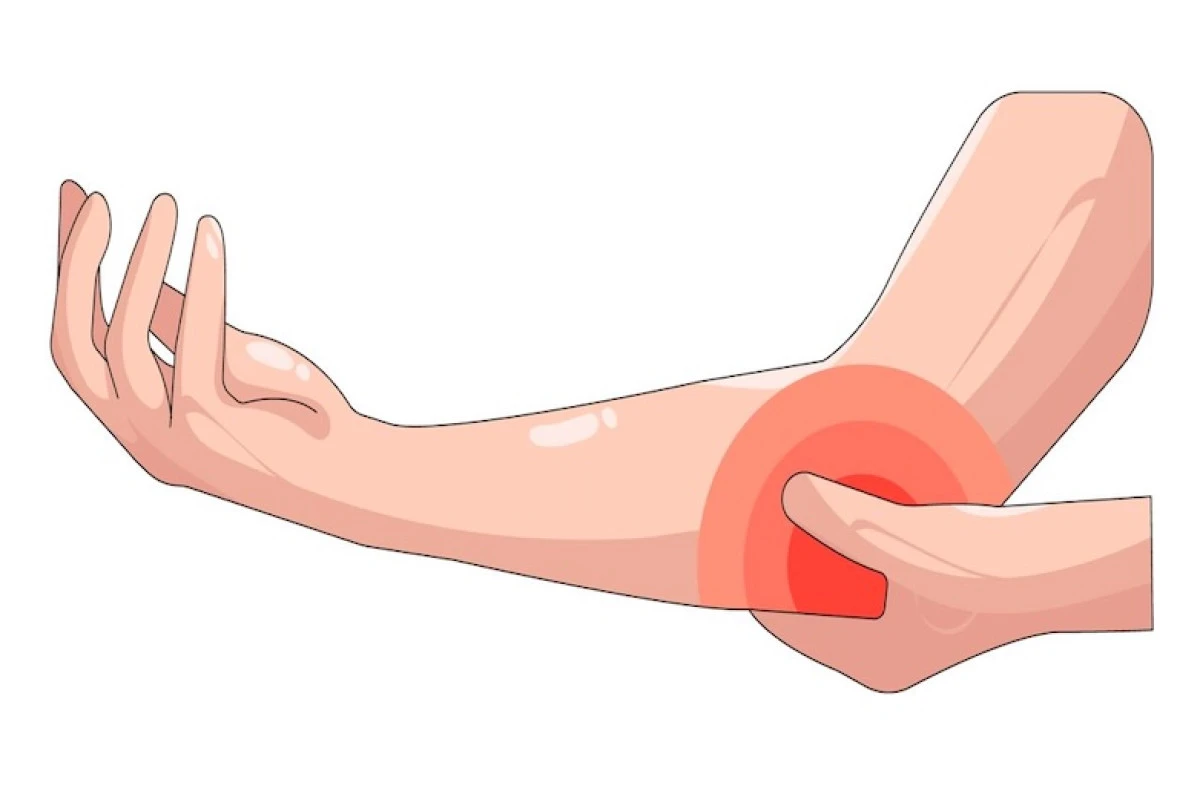 Ulnar Sinir Sıkışması (Dirsek Kanalı Darlığı) Üzerine Yapılan Çalışmalarda Dikkat Çeken Bulgular